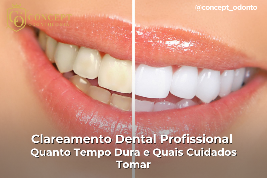 clareamento dental profissional